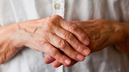 reumatoidni artritis kao uzrok bolova u zglobovima prstiju