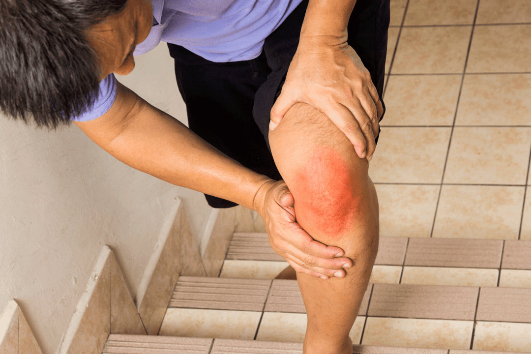 bol u zglobovima zbog artroze