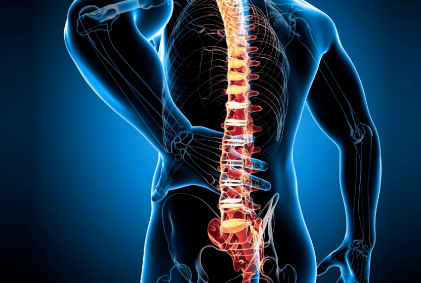 Osteohondrosis